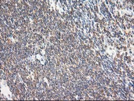 MAPRE2 / EB2 Antibody (clone OTI7A2)