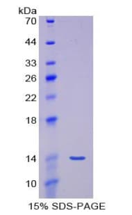 Human MSTN / GDF8 / Myostatin Protein (Recombinant His, N-terminus)
