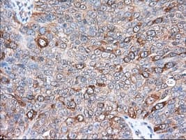 ERIC-1 / TACC3 Antibody (clone OTI7B11)