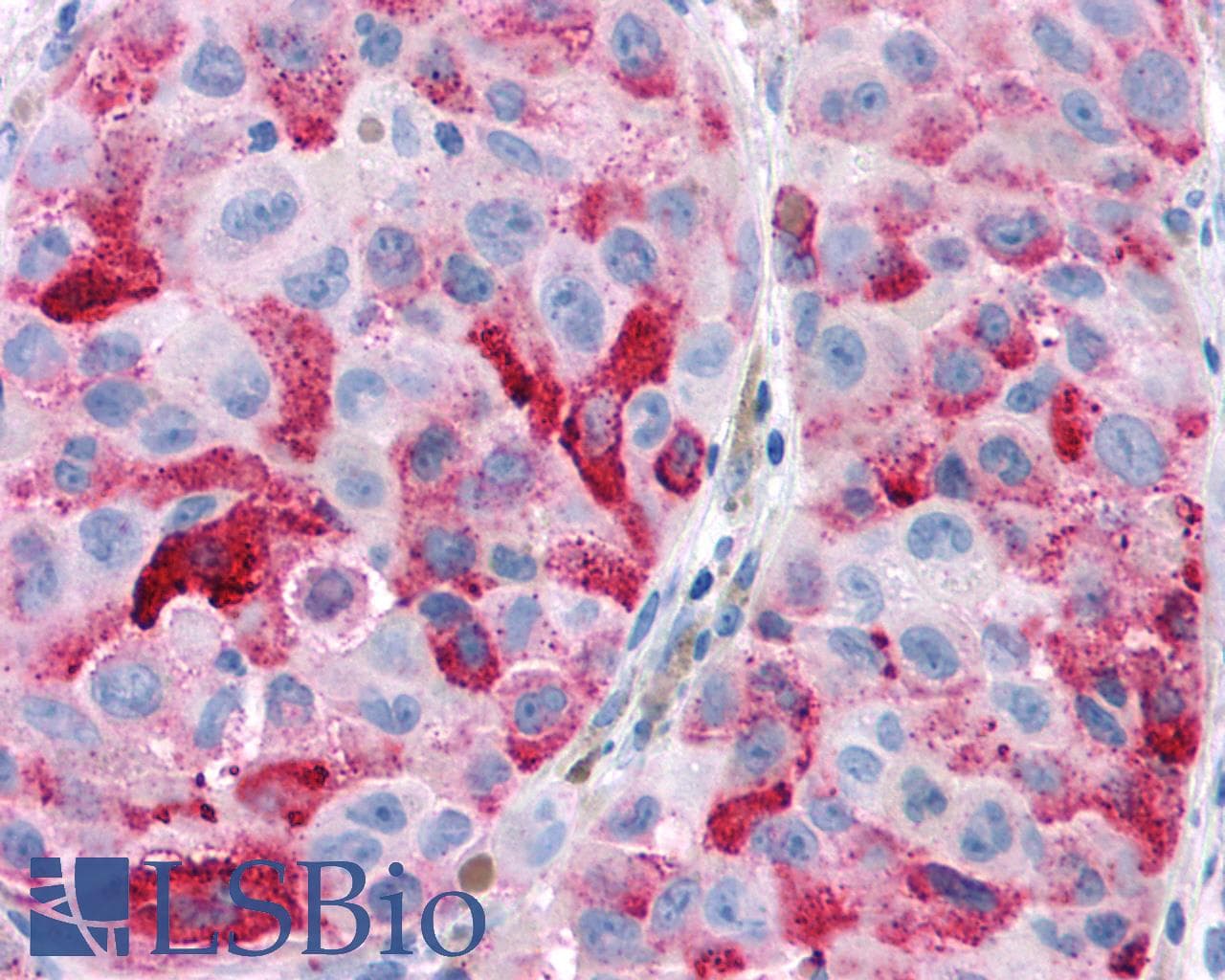 IHC-plus™ CNR2 / CB2 Antibody (Cytoplasmic Domain)