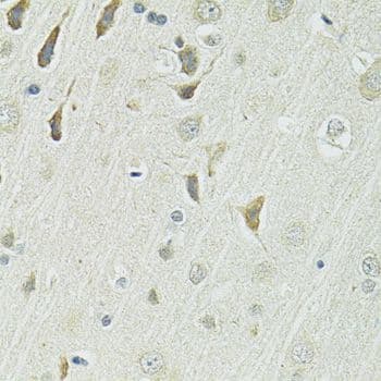 SLC1A4 / ASCT1 Antibody