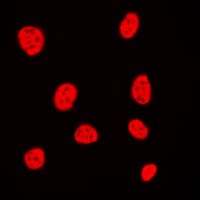 Polyclonal Rabbit anti-Human Histone H3 Antibody (N-Terminus, IHC, IF, WB)