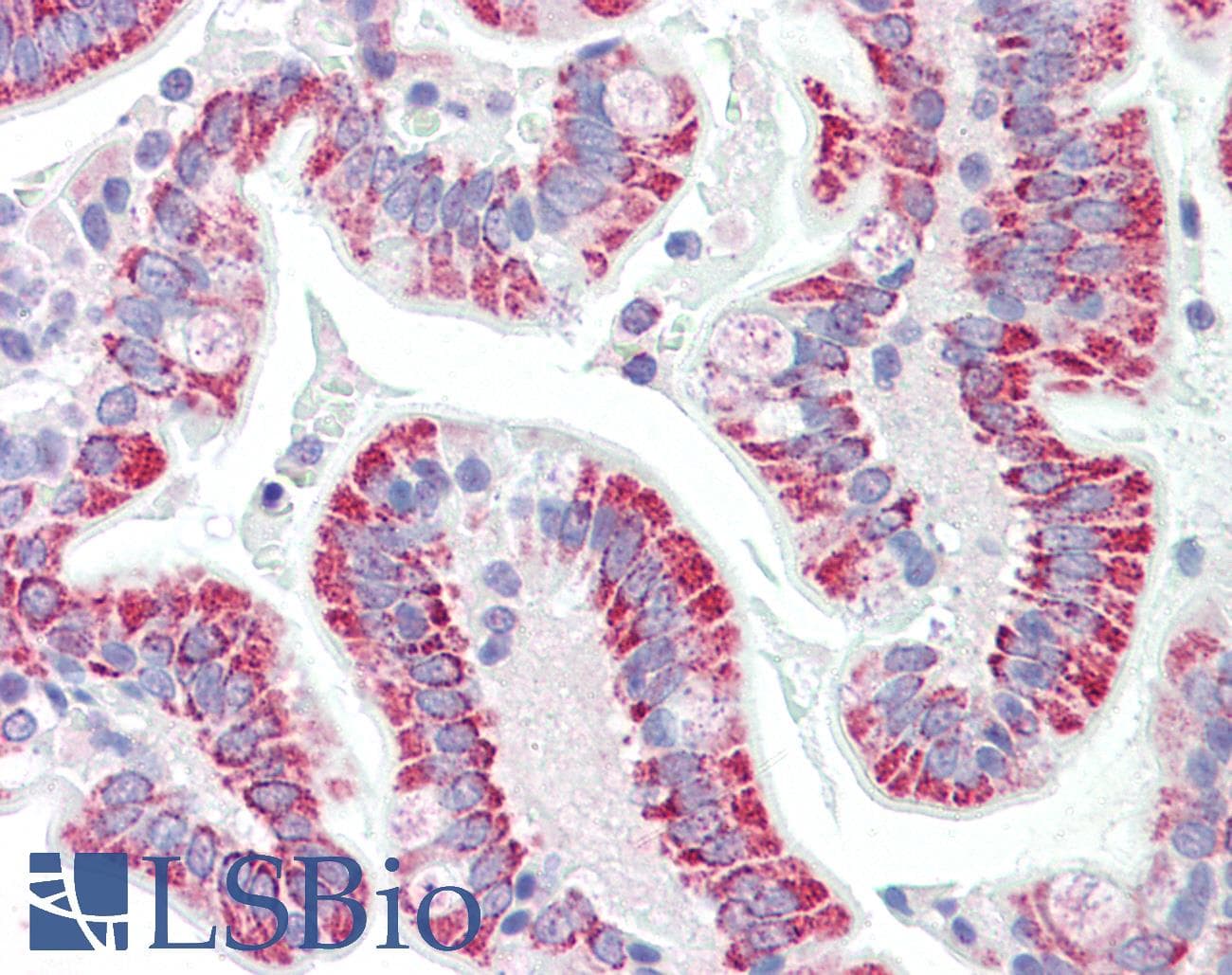 IHC-plus™ Polyclonal Goat anti-Human DBP5 / SON Antibody (aa89-101, IHC)