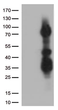 Monoclonal Mouse anti-Human ASH2L / ASH2 Antibody (clone OTI1A4, aa347-628, WB)