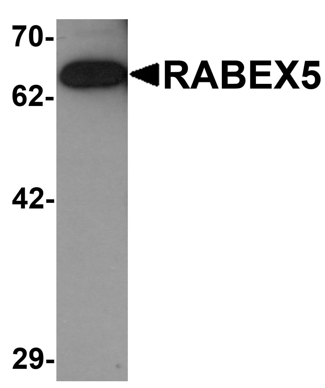 RABGEF1 Antibody