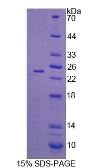 Mouse SHBG Protein (Recombinant His-S)