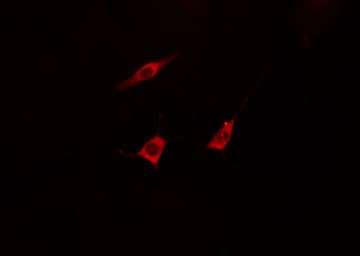Polyclonal Rabbit anti-Human KCNA5 / Kv1.5 Antibody (IF, WB)