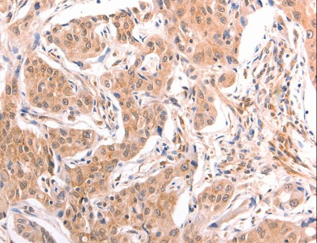 Polyclonal Rabbit anti-Human LTA / TNF Beta Antibody (IHC)