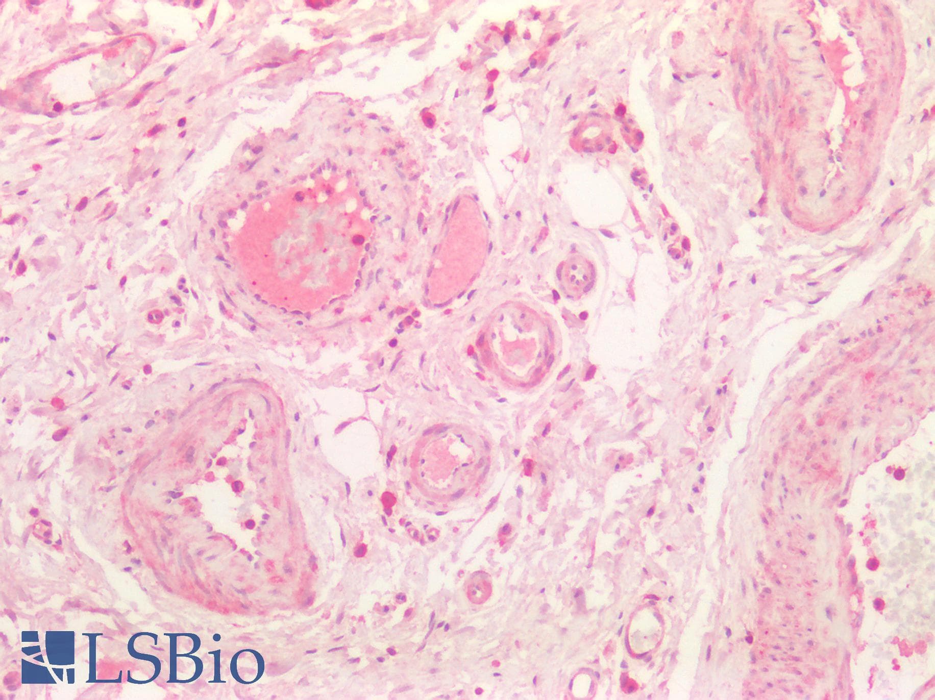 PathPlus™ KNG1 / Kininogen / Bradykinin Antibody (aa58-70)