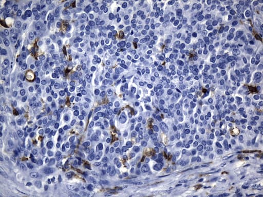 Monoclonal Mouse anti-Human MSR1 / CD204 Antibody (clone UMAB246, Carrier-free, aa197-451, IHC)