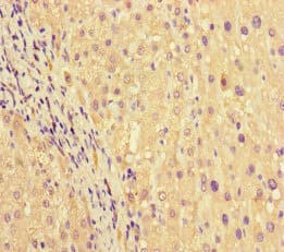 PRG2 / Proteoglycan 2 Antibody