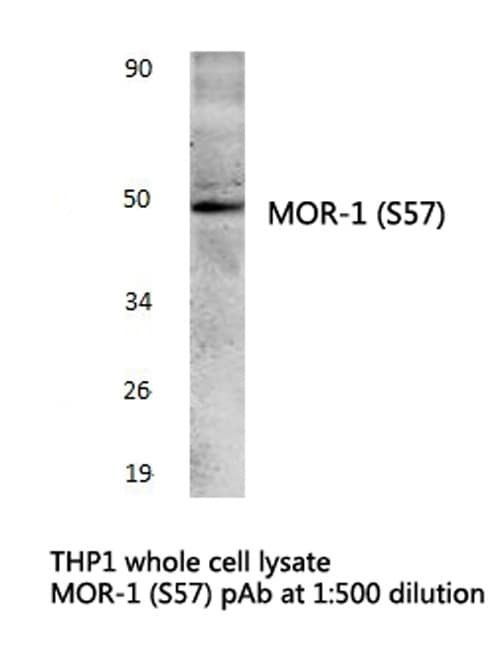 OPRM1 / Mu Opioid Receptor Antibody (Ser57)
