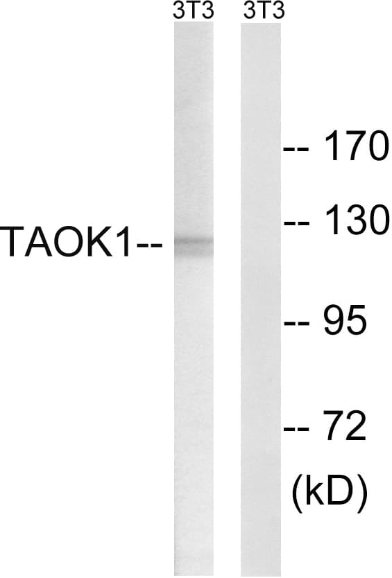 IHC-plus™ Polyclonal Rabbit anti-Human TAOK1 / TAO1 Antibody (aa431-480, IHC, WB)