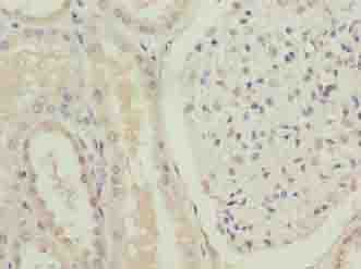 Polyclonal Rabbit anti-Human FOXR2 Antibody (IHC, WB)