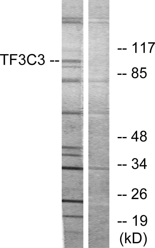 Polyclonal Rabbit anti-Human GTF3C3 Antibody (WB)