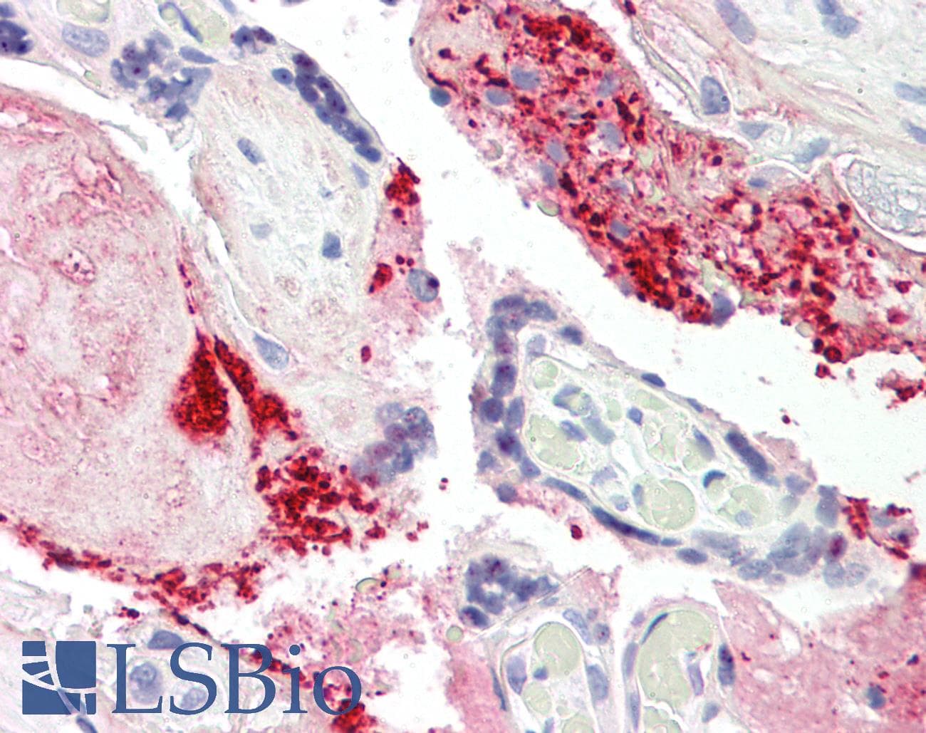 IHC-plus™ COL1A2 / Collagen I Alpha 2 Antibody (aa471-520)