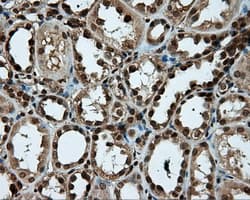Monoclonal Mouse anti-Human PSMC3 Antibody (clone OTI1C10, IHC, IF, WB)
