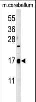 C1orf95 Antibody (aa114-141)