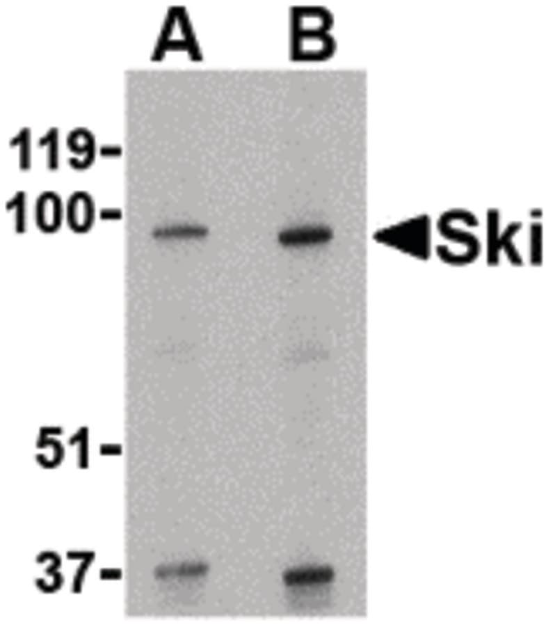 IHC-plus™ SKI Antibody
