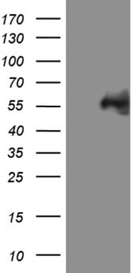 MYCN / N-myc Antibody (aa229-464, clone OTI2E5)