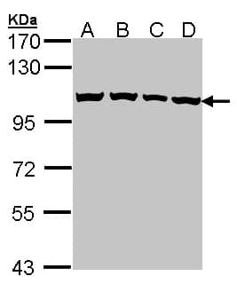 Polyclonal Rabbit anti-Human CSE1L Antibody (aa222-469, IHC, WB)