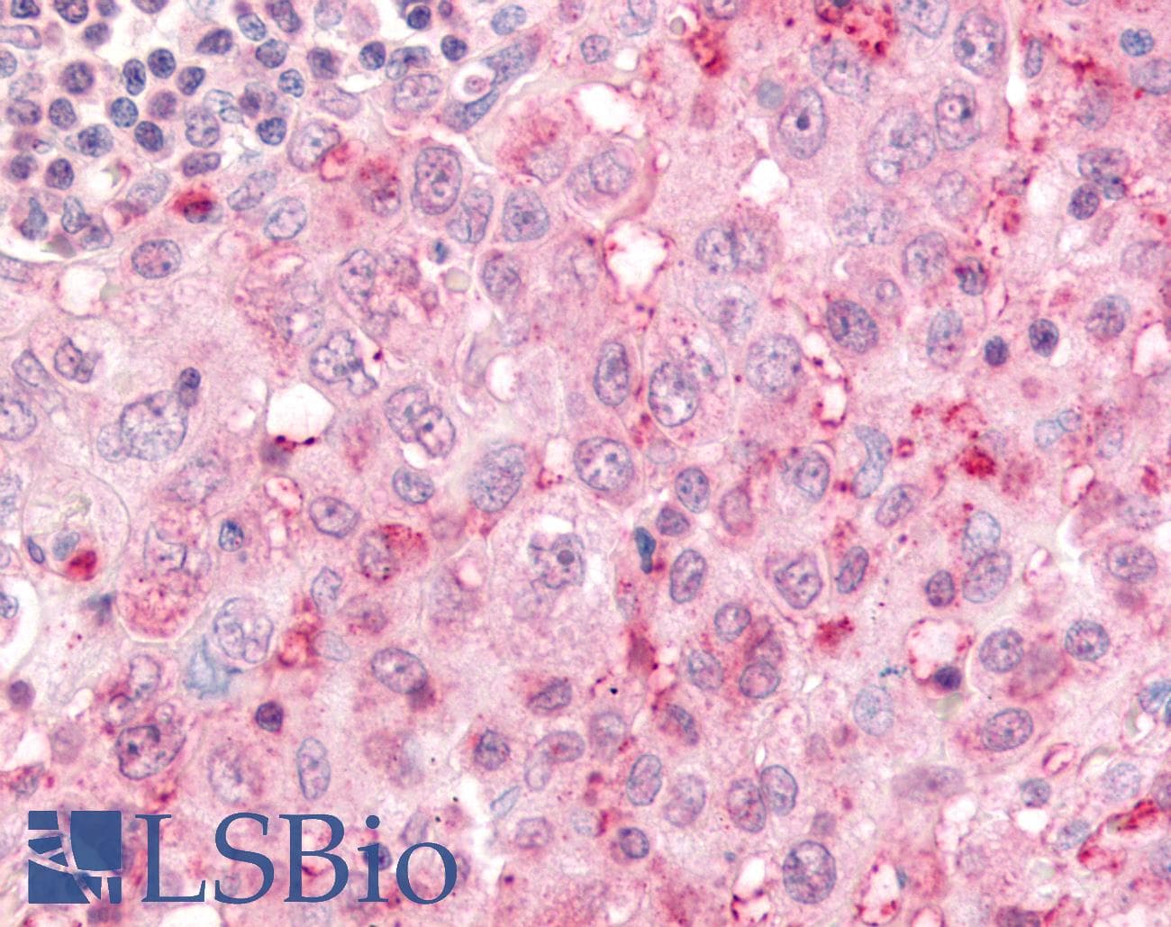IHC-plus™ Polyclonal Rabbit anti-Human USP4 Antibody (Internal, IHC)