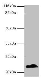Polyclonal Rabbit anti-Human NDUFB5 Antibody (aa94-189, WB)
