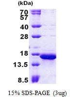 Human TOMM20 Protein (Recombinant His)