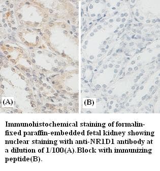 Polyclonal Rabbit anti-Human NR1D1 Antibody (IHC)
