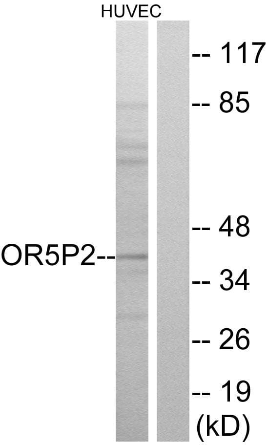 OR5P2 Antibody