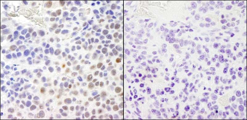 Polyclonal Rabbit anti-Human RPA2 / RFA2 / RPA34 Antibody (phospho-Ser4/8, IHC, IF)