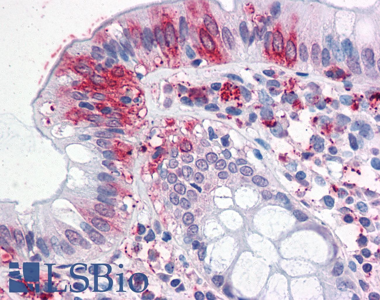 IHC-plus™ Polyclonal Rabbit anti-Human NPTN / SDR1 Antibody (Internal, IHC)