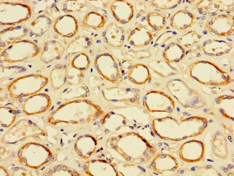 Polyclonal Rabbit anti-Human TFDP2 / DP2 Antibody (IHC, WB)