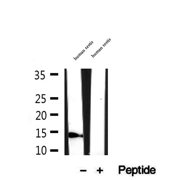 SSNA1 Antibody