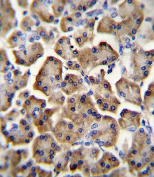 BTC / Betacellulin Antibody (aa17-45)