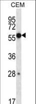 Polyclonal Rabbit anti-Human ZNF764 Antibody (aa84-113, IHC, WB)