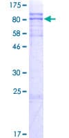 Human ZNF238 Protein (Recombinant GST)