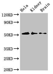IP6K1 Antibody