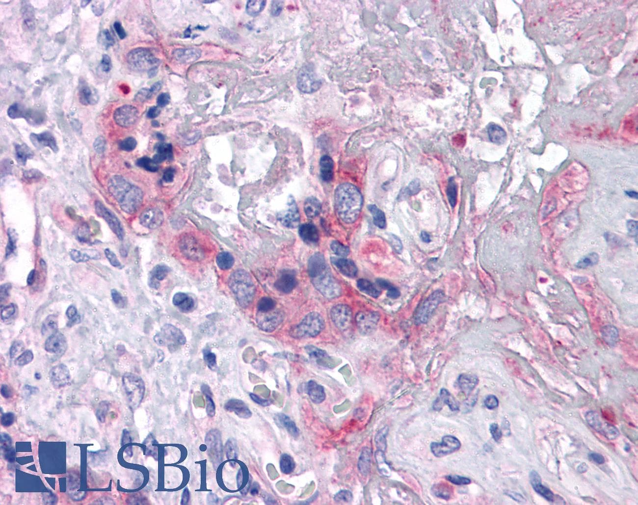 IHC-plus™ Monoclonal Mouse anti-Human ERN1 / IRE1 Antibody (clone 9F2, IHC, WB)