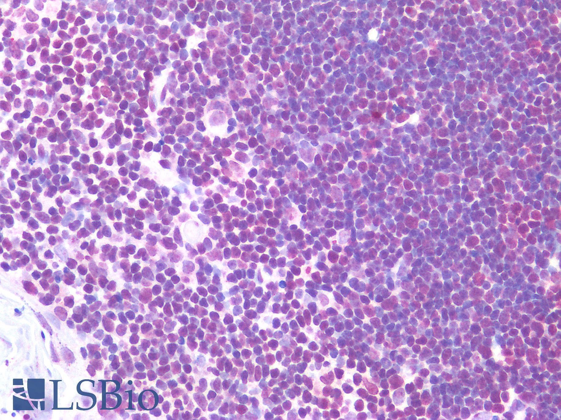 IHC-plus™ TERT / Telomerase Antibody