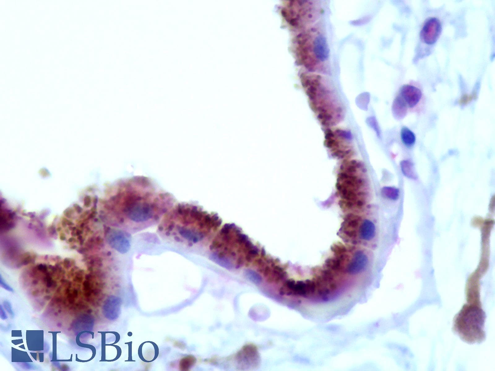 IHC-plus™ RDH1 / RDH5 Antibody (aa19-31)