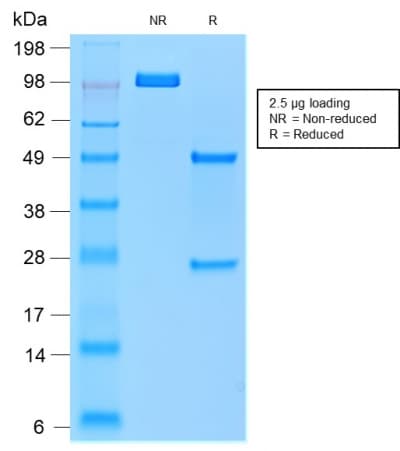 Recombinant Monoclonal Mouse anti-Human ACP5 / TRAP Antibody (clone rACP5/1070, IHC)