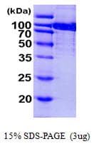 Human ACO1 / Aconitase Protein (Recombinant His)