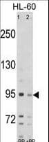 SEMA6A / Semaphorin 6A Antibody (aa998-1028)