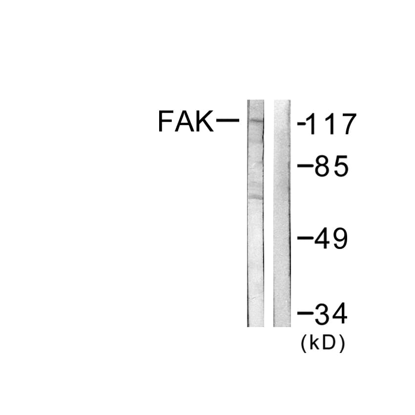 FAK / Focal Adhesion Kinase Antibody (aa542-591)