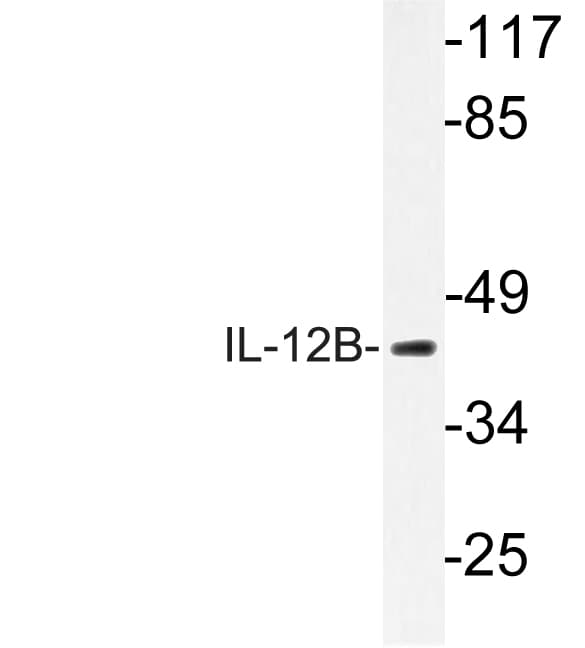 IL12B / IL12 p40 Antibody (aa228-277)