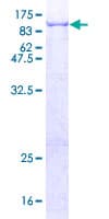 Human ALOXE3 Protein (Recombinant GST)