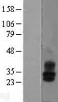 Human KCNMB2 Protein (Over-Expression Lysate Myc-DDK (Flag))