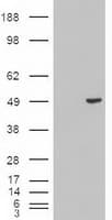 KRT18 / CK18 / Cytokeratin 18 Antibody (clone OTI1E1)