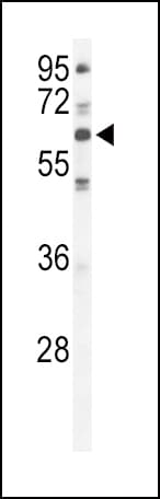 PRKCI / PKC Iota Antibody (aa176-207)